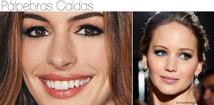  pálpebras caídas